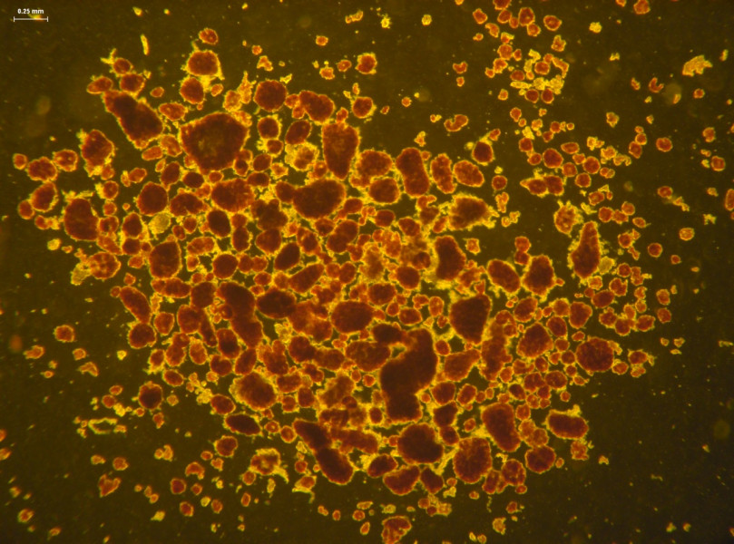 Fresh Human Pancreatic Islets in IEQ (islet equivalents)